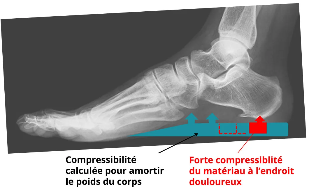 Principes des semelles